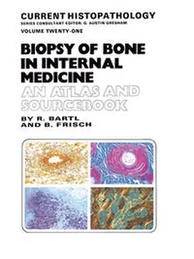 Bartl / Frisch |  Biopsy of Bone in Internal Medicine: An Atlas and Sourcebook | eBook | Sack Fachmedien