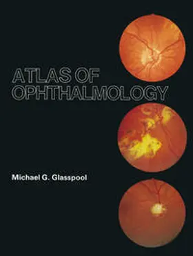 Glasspool |  Atlas of Ophthalmology | eBook | Sack Fachmedien