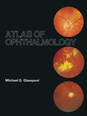 Glasspool |  Atlas of Ophthalmology | Buch |  Sack Fachmedien