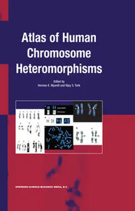 Wyandt / Tonk | Atlas of Human Chromosome Heteromorphisms | E-Book | www.sack.de