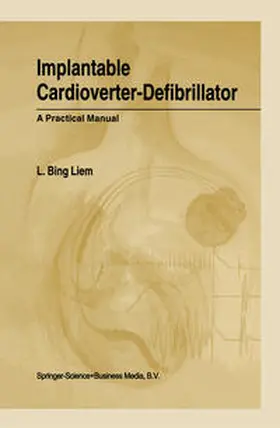 Liem | Implantable Cardioverter-Defibrillator | E-Book | www.sack.de