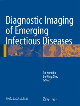 Lu / Zhou |  Diagnostic Imaging of Emerging Infectious Diseases | Buch |  Sack Fachmedien