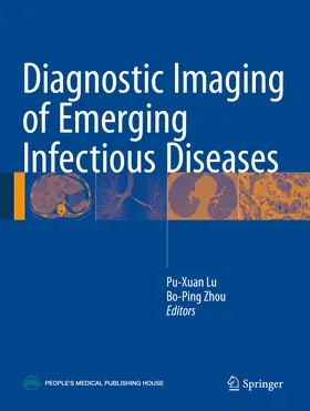 Lu / Zhou |  Diagnostic Imaging of Emerging Infectious Diseases | eBook | Sack Fachmedien
