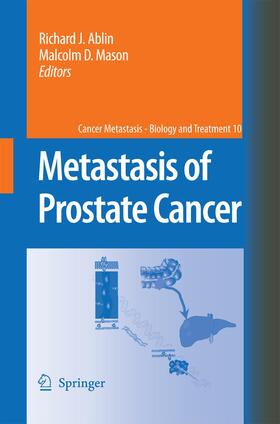 Mason / Ablin | Metastasis of Prostate Cancer | Buch | 978-94-017-8152-7 | sack.de