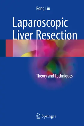 Liu |  Laparoscopic Liver Resection | eBook | Sack Fachmedien
