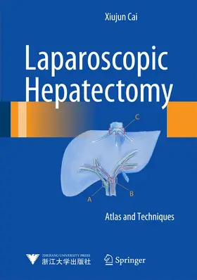 Cai | Laparoscopic Hepatectomy | Buch | 978-94-017-9839-6 | www.sack.de