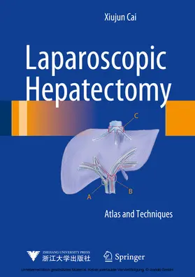 Cai |  Laparoscopic Hepatectomy | eBook | Sack Fachmedien