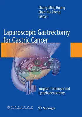 Zheng / Huang |  Laparoscopic Gastrectomy for Gastric Cancer | Buch |  Sack Fachmedien