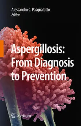 Comarú Pasqualotto |  Aspergillosis: from diagnosis to prevention | Buch |  Sack Fachmedien