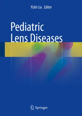 Liu | Pediatric Lens Diseases | E-Book | sack.de
