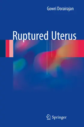 Dorairajan |  Ruptured Uterus | eBook | Sack Fachmedien