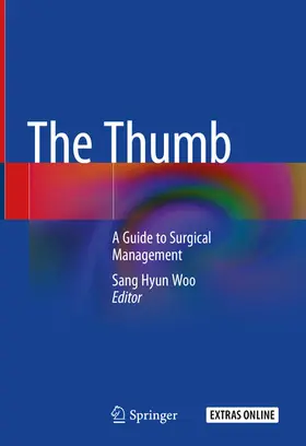 Woo | The Thumb | E-Book | www.sack.de