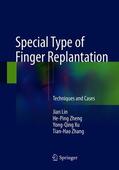 Lin / Zhang / Zheng |  Special Type of Finger Replantation | Buch |  Sack Fachmedien