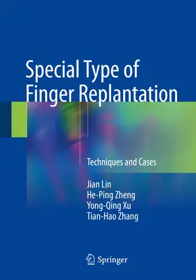 Lin / Zheng / Xu | Special Type of Finger Replantation | E-Book | www.sack.de