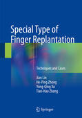 Lin / Zheng / Xu |  Special Type of Finger Replantation | eBook | Sack Fachmedien