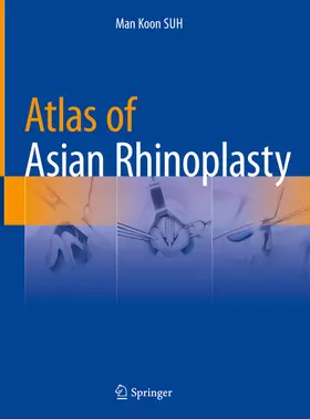 SUH |  Atlas of Asian Rhinoplasty | eBook | Sack Fachmedien