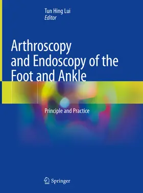 Lui |  Arthroscopy and Endoscopy of the Foot and Ankle | eBook | Sack Fachmedien