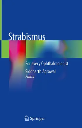 Agrawal |  Strabismus | eBook | Sack Fachmedien