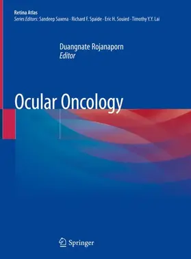 Rojanaporn |  Ocular Oncology | Buch |  Sack Fachmedien