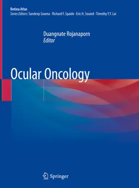 Rojanaporn |  Ocular Oncology | eBook | Sack Fachmedien