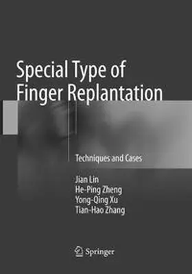 Lin / Zhang / Zheng |  Special Type of Finger Replantation | Buch |  Sack Fachmedien