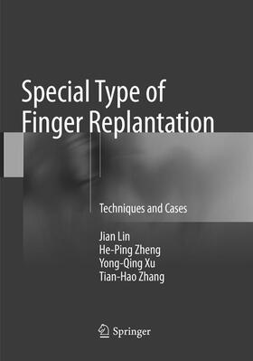 Lin / Zhang / Zheng | Special Type of Finger Replantation | Buch | sack.de