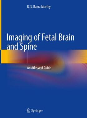 Rama Murthy | Imaging of Fetal Brain and Spine | Buch | 978-981-1358-43-2 | sack.de