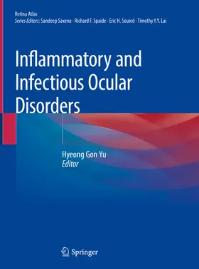 Yu |  Inflammatory and Infectious Ocular Disorders | eBook | Sack Fachmedien