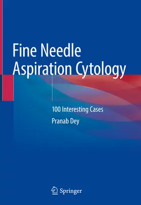 Dey |  Fine Needle Aspiration Cytology | eBook | Sack Fachmedien