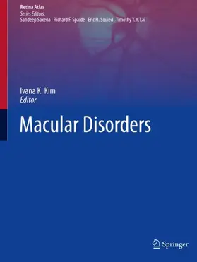 Kim |  Macular Disorders | Buch |  Sack Fachmedien