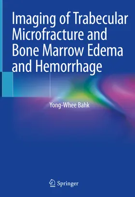 Bahk |  Imaging of Trabecular Microfracture and Bone Marrow Edema and Hemorrhage | eBook | Sack Fachmedien