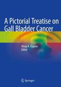 Kapoor |  A Pictorial Treatise on Gall Bladder Cancer | Buch |  Sack Fachmedien