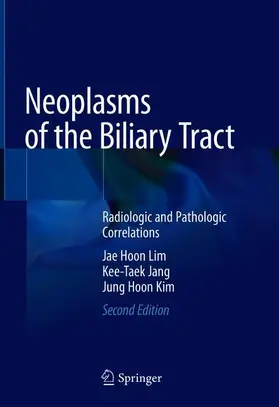 Lim / Kim / Jang |  Neoplasms of the Biliary Tract | Buch |  Sack Fachmedien
