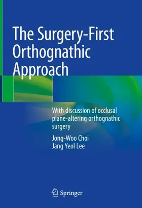 Choi / Lee | The Surgery-First Orthognathic Approach | Buch | 978-981-15-7540-2 | www.sack.de