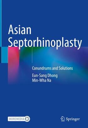 Na / Dhong |  Asian Septorhinoplasty | Buch |  Sack Fachmedien
