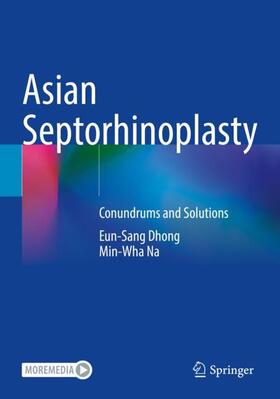 Na / Dhong |  Asian Septorhinoplasty | Buch |  Sack Fachmedien