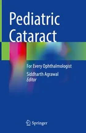 Agrawal |  Pediatric Cataract | eBook | Sack Fachmedien