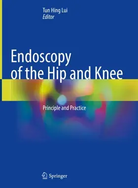 Lui |  Endoscopy of the Hip and Knee | Buch |  Sack Fachmedien