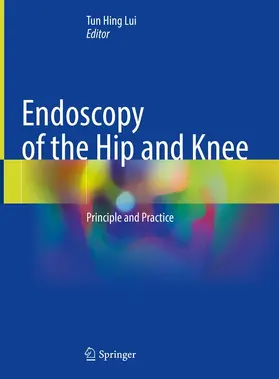 Lui |  Endoscopy of the Hip and Knee | eBook | Sack Fachmedien