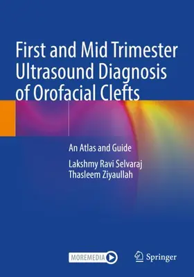 Ziyaullah / Selvaraj |  First and Mid Trimester Ultrasound Diagnosis of Orofacial Clefts | Buch |  Sack Fachmedien