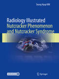 Kim |  Radiology Illustrated: Nutcracker Phenomenon and Nutcracker Syndrome | eBook | Sack Fachmedien