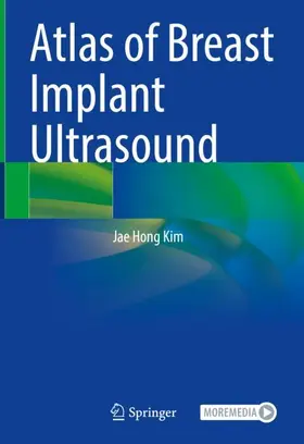 Kim |  Atlas of Breast Implant Ultrasound | Buch |  Sack Fachmedien