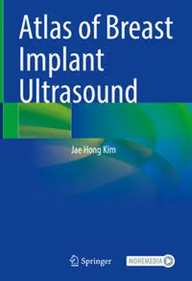 Kim |  Atlas of Breast Implant Ultrasound | eBook | Sack Fachmedien