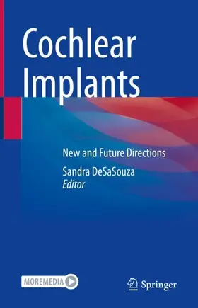 DeSaSouza | Cochlear Implants | Buch | 978-981-19-0451-6 | www.sack.de