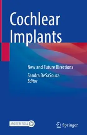 DeSaSouza |  Cochlear Implants | eBook | Sack Fachmedien