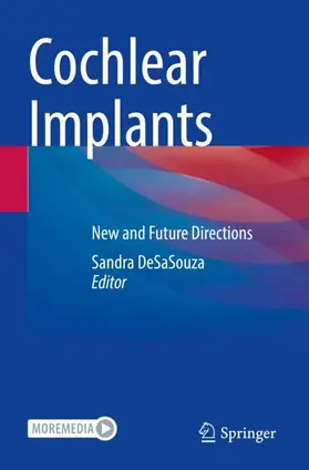 DeSaSouza | Cochlear Implants | Buch | 978-981-19-0454-7 | www.sack.de