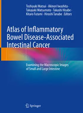 Matsui / Iwashita / Matsumoto | Atlas of Inflammatory Bowel Disease-Associated Intestinal Cancer | E-Book | www.sack.de