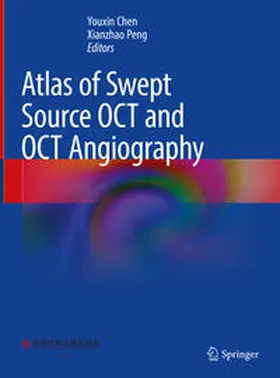 Chen / Peng | Atlas of Swept Source OCT and OCT Angiography | E-Book | sack.de