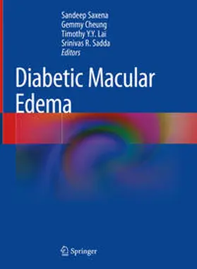Saxena / Cheung / Lai | Diabetic Macular Edema | E-Book | sack.de