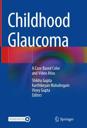 Gupta / Mahalingam |  Childhood Glaucoma | Buch |  Sack Fachmedien